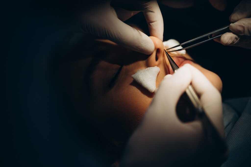 rinoplastia